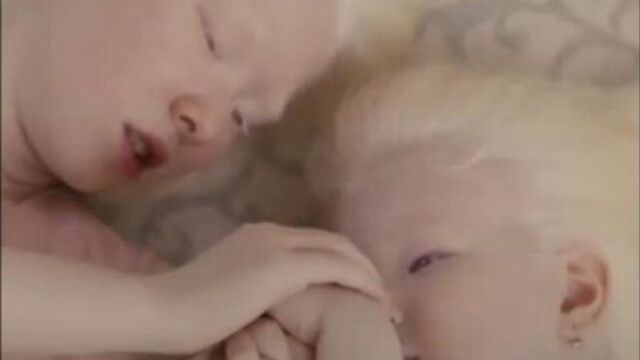 Сестры с необычной внешностью - альбиносы