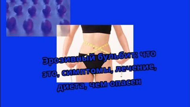 Эрозивный бульбит: что это, симптомы, лечение, диета, чем опасен