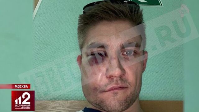 Актёр избил хоккеиста | подробности