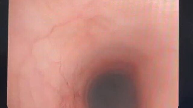 Video by государственная ветеринарная клиника спб