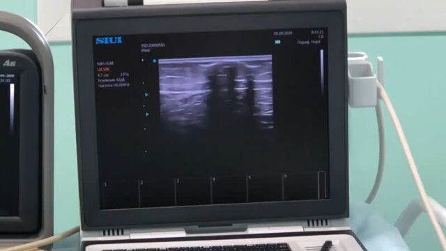 Video by ситимед | медицинский центр йошкар-ола