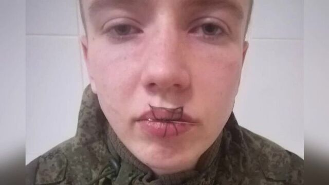 В челябинской области свердловский солдат-срочник после ссоры с девушкой зашил себе рот.