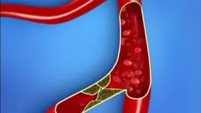 Коэнзим qh - уникальный продукт от компании beverlee club