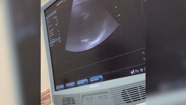 Video by клиника нева | киров