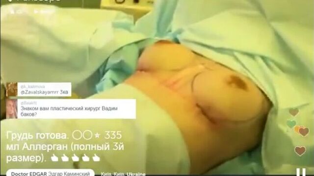 Доктор эдгар презентует грудь третьего размера