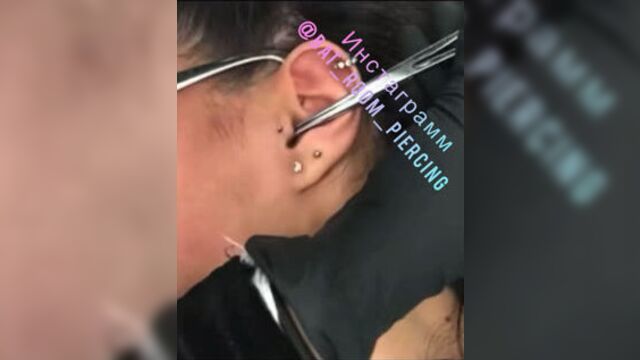 Прокол козелка трагус