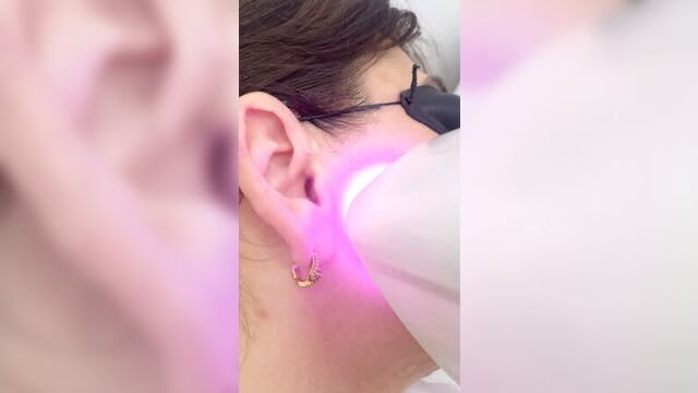 Video by lazer house•лазерная и электроэпиляция / челны