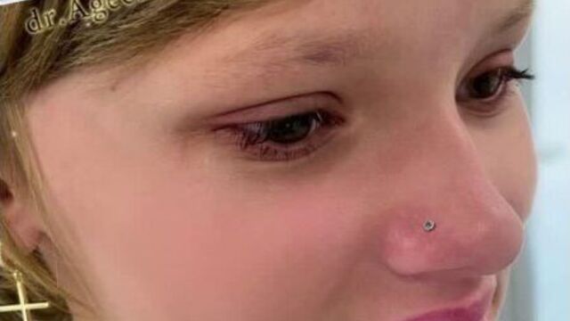 Все виды пирсинга. пирсинг уха. проколоть нос. прокол носа. нострил. прокол крыла носа. клиника академик город искитим