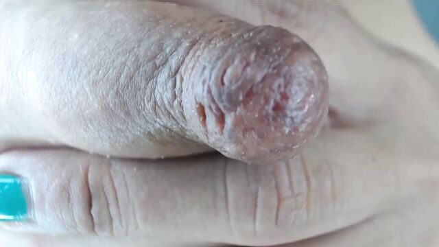 Massive milky nipples