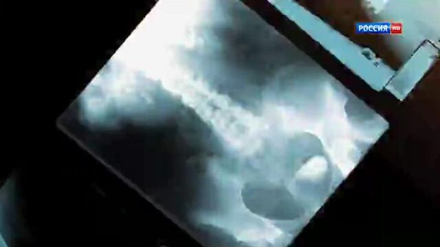 Трейлер; склифосовский 2 сезон 1 серия с 25.03.19 в сообществе "склифосовский"